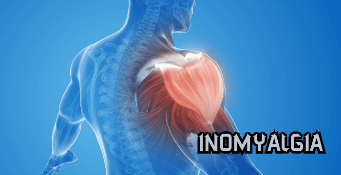 Inomyalgia Treatment & Management – Full Analysis